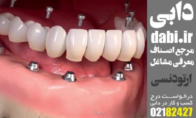 انجام ارتودنسی بعد از ایمپلنت