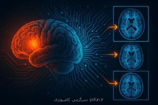 پیشبینی بازگشت تومور مغزی در کودکان با هوش مصنوعی